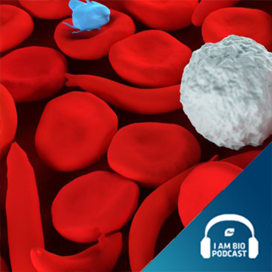 Sickle Cell