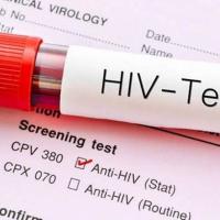 HIV Test